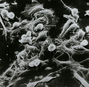 national cancer institute wug8xhj3abs unsplash compressed